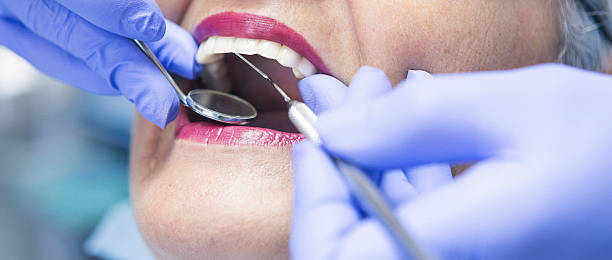 Best Emergency Dentist for Lost Fillings or Crowns in Branson, MO